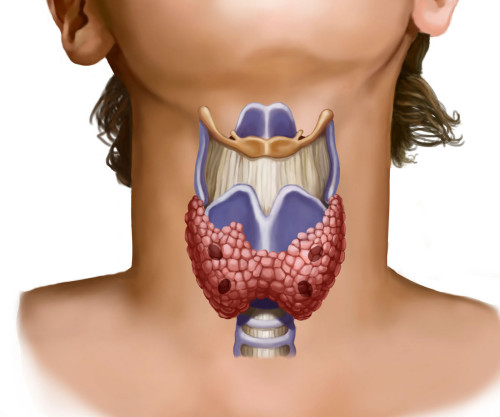 Гипоплазия щитовидной железы 
