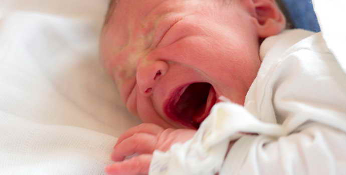 Менингит у новорожденных: причины, симптомы, лечение