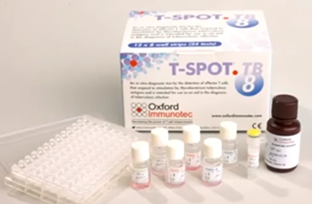 Тест на туберкулез Т-SPOT.TB