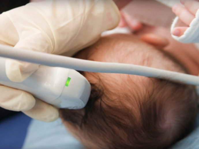 субэпендимальная киста у новорожденного ребенка диагностика
