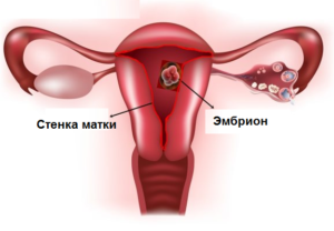 прикрепление эмбриона к стенке матки