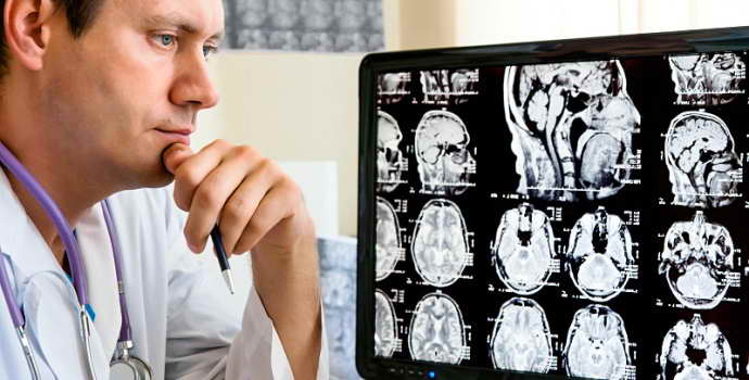 Когда стоит делать МРТ головного мозга с расшифровкой, и что дает такой метод диагностики
