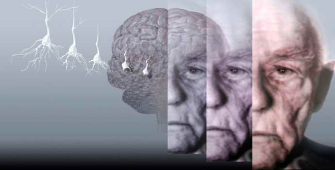 Болезнь Альцгеймера нельзя вылечить, но можно затормозить